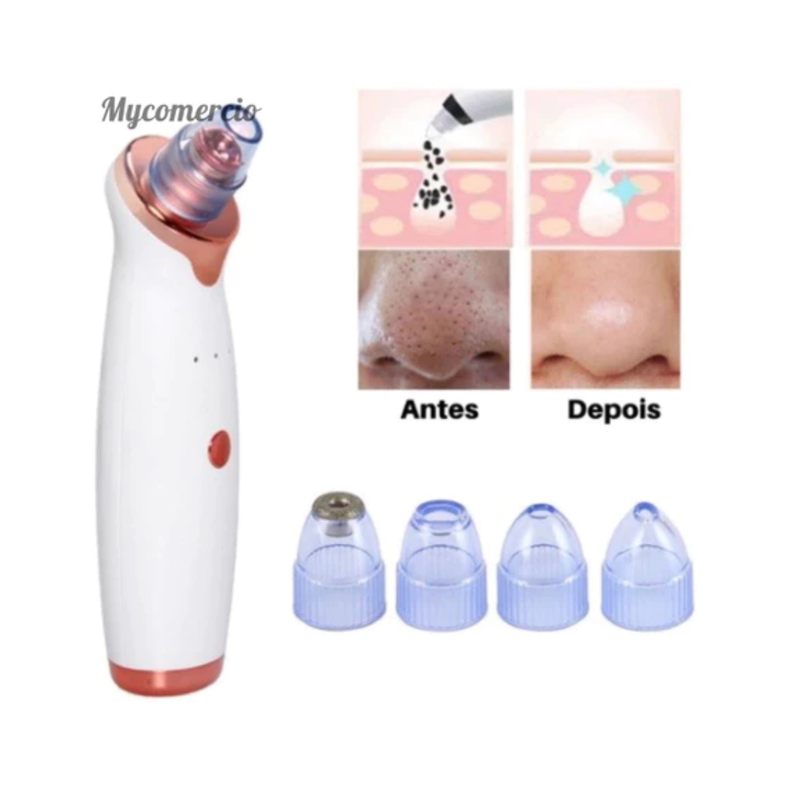 Removedor Cravos e Espinhas Sucção a Vácuo Aparelho Recarregável