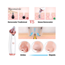 Removedor Cravos e Espinhas Sucção a Vácuo Aparelho Recarregável